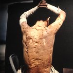 Radiation scars | Photo taken by peter e